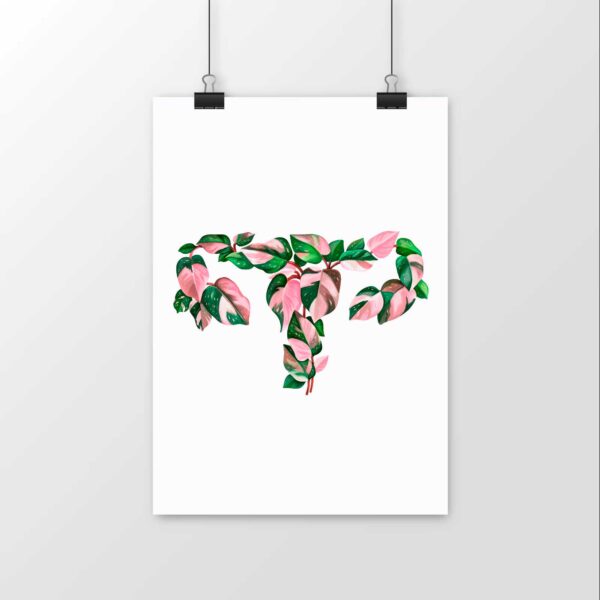 Tropical Uterus